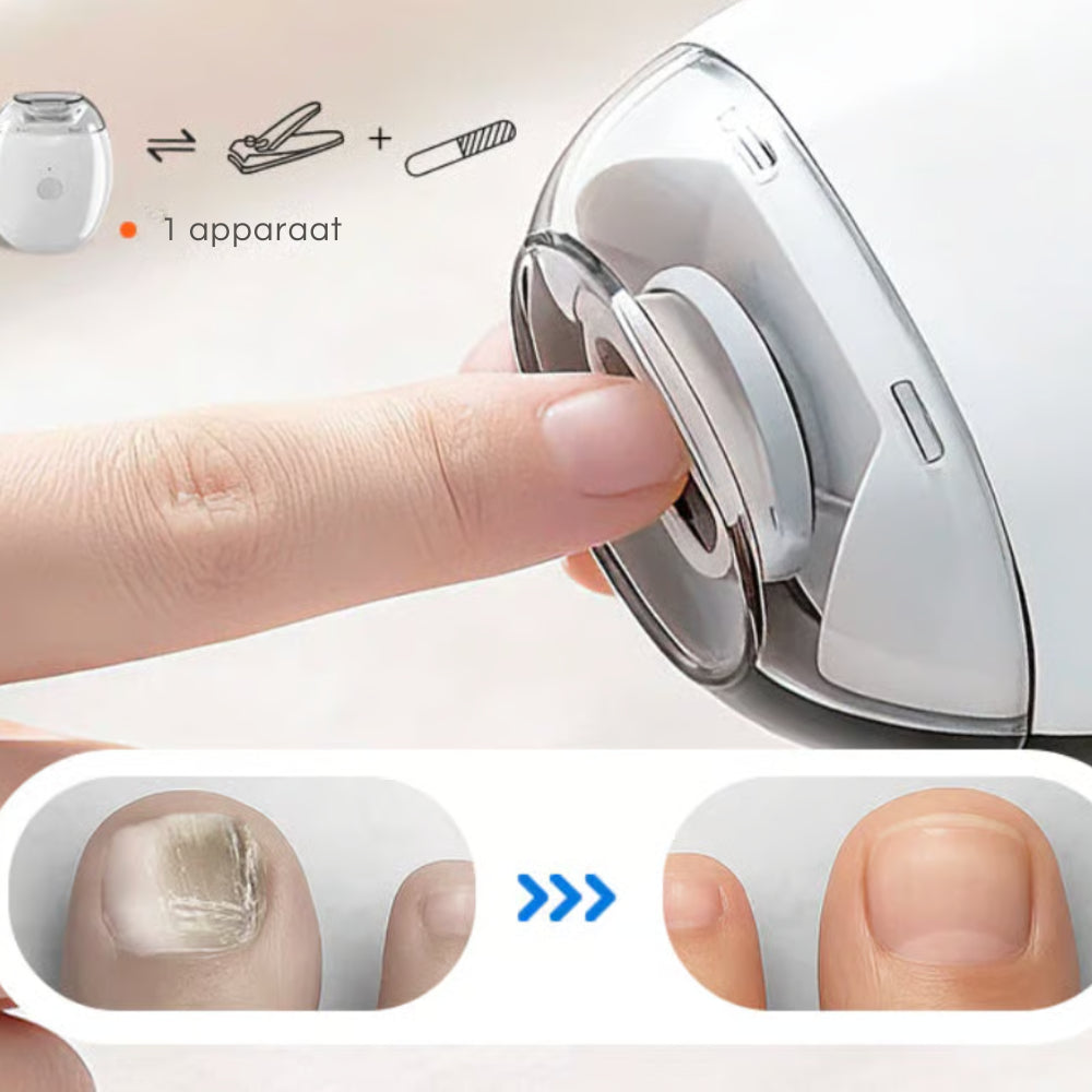 SmoothTrim™ Αυτόματη Περιποίηση Νυχιών | Έως 96% τέλεια περιποιημένα νύχια σε μόλις λίγα δευτερόλεπτα!