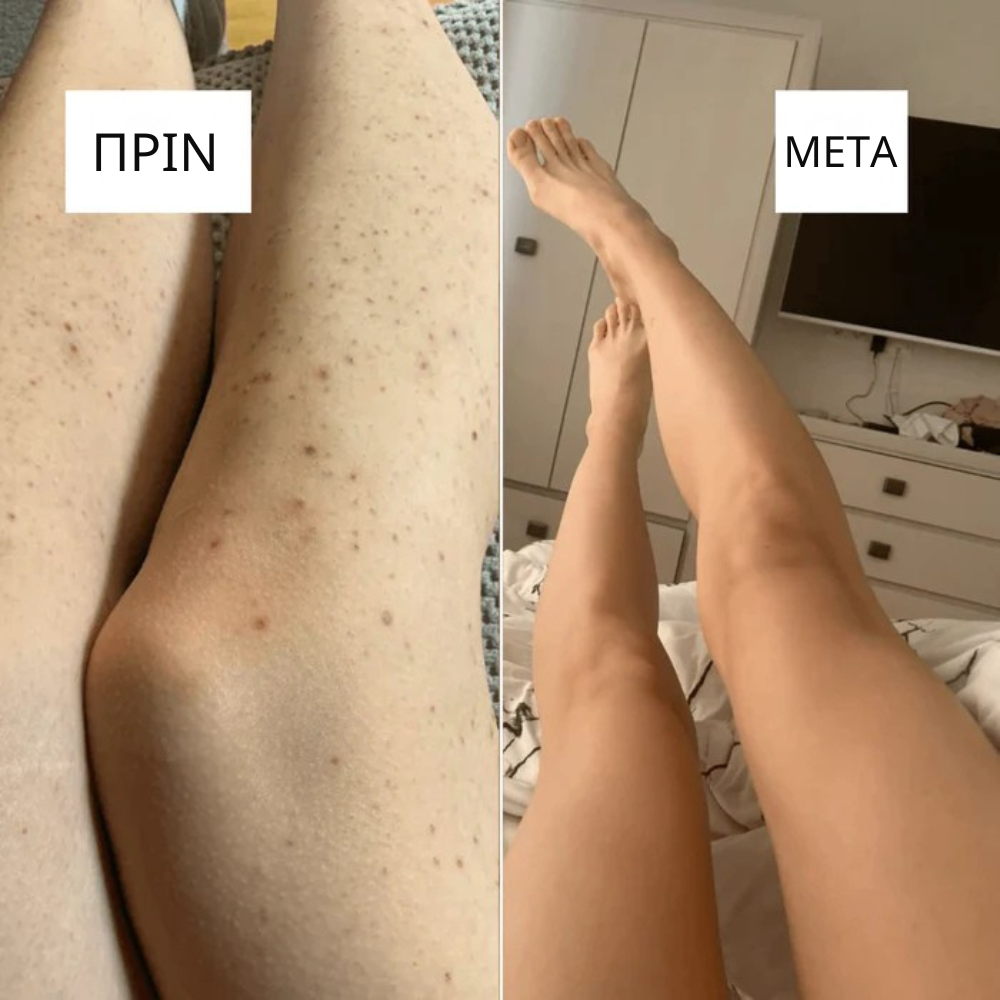 Αυθεντικό Ξυραφάκι – Προσωρινά 10 ΔΩΡΕΑΝ ανταλλακτικές λεπίδες