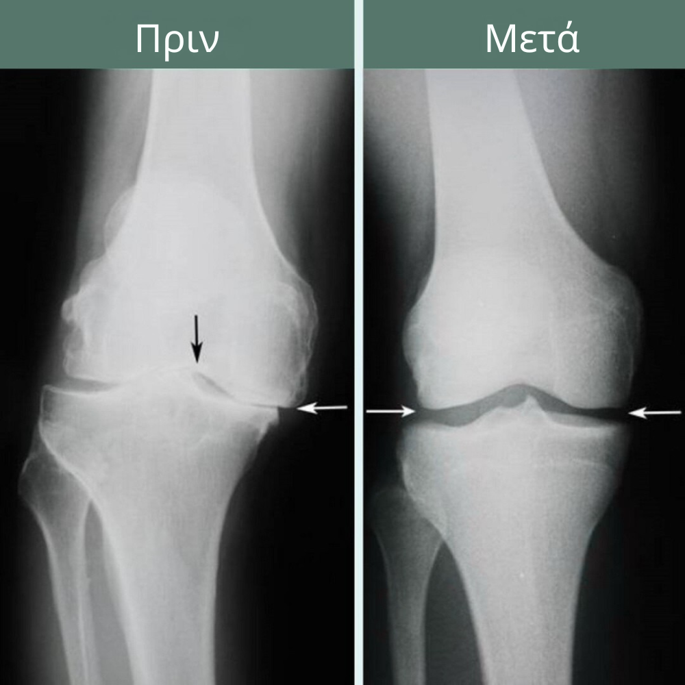 Relivio – Κίνηση Χωρίς Πόνο Μέσα σε 7 Ημέρες,