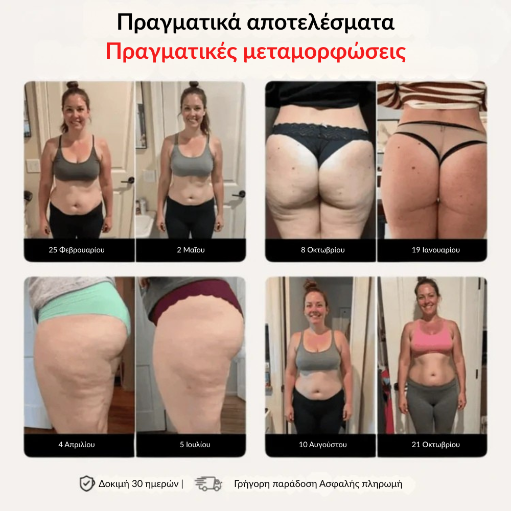 LYMERA 3D Κολάν – Πες με φυσικό τρόπο αντίο στον πόνο και την ενόχληση από το λιποίδημα