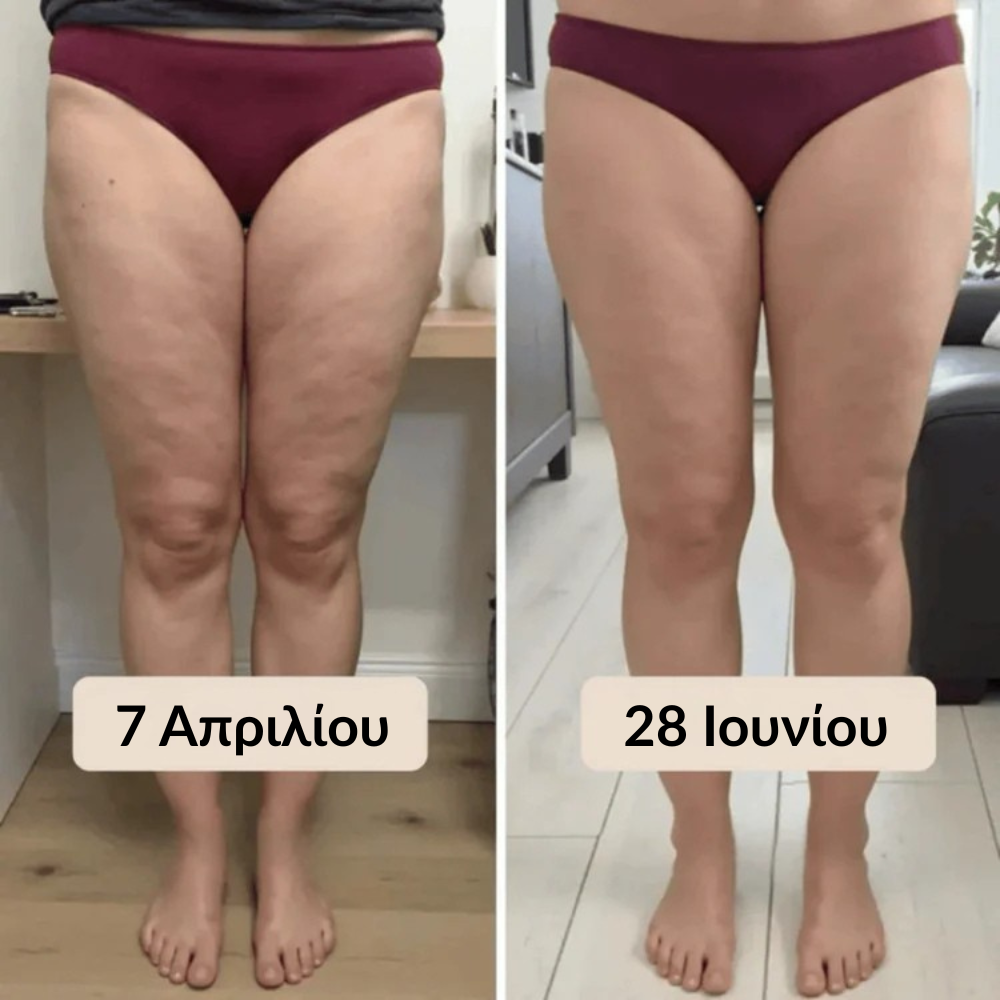 LYMERA 3D Κολάν – Πες με φυσικό τρόπο αντίο στον πόνο και την ενόχληση από το λιποίδημα