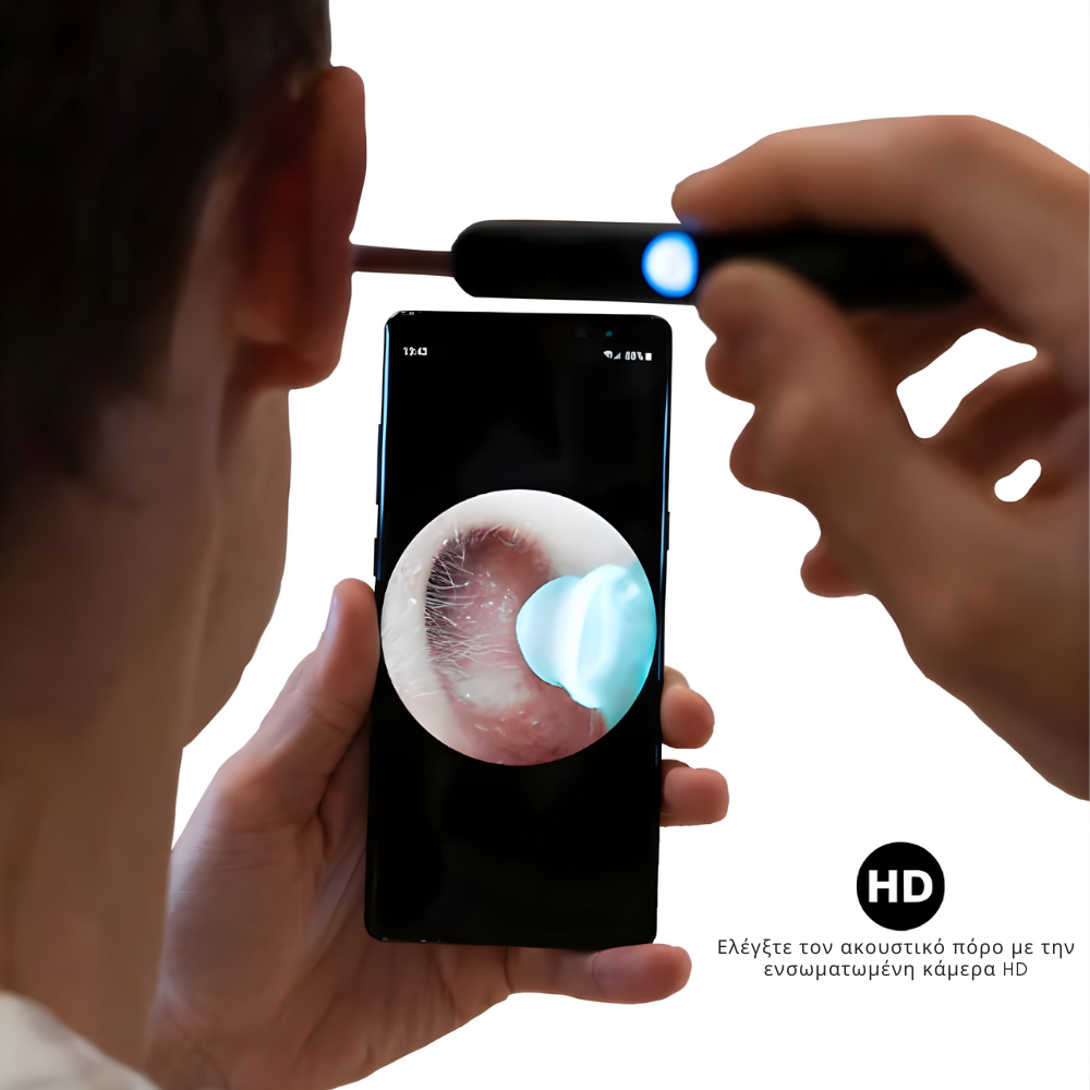 CleanEar Pro – Έξυπνος καθαρισμός αυτιών με προηγμένη τεχνολογία