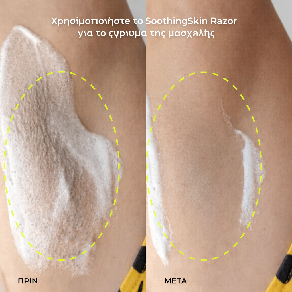 Αυθεντικό Ξυραφάκι – Προσωρινά 10 ΔΩΡΕΑΝ ανταλλακτικές λεπίδες